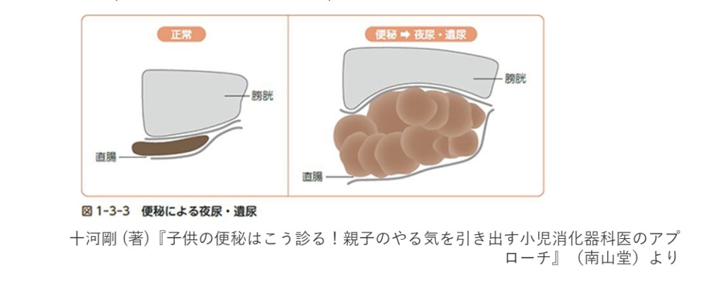 夜尿と便秘の関連